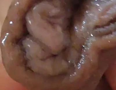 Large Foreskin and Balls in Striking Close-up.