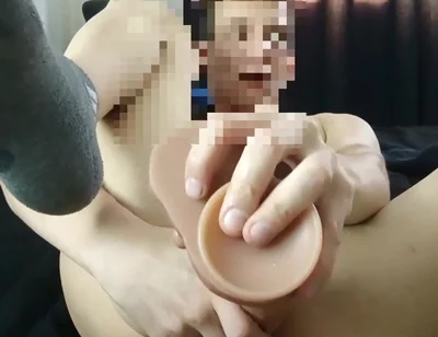 Anal Gaping