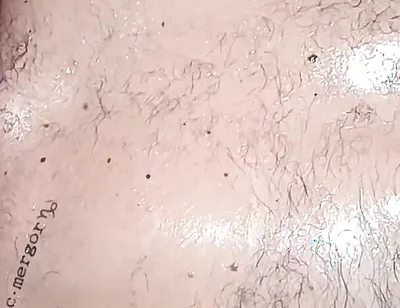 Stillness and Skin