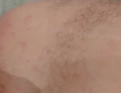 Masturbation