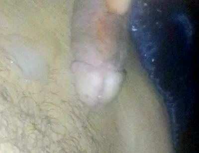 Boy Roasts His Straw and Smears It All Over His Stomach at Night While His Parents Are Away