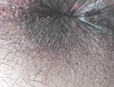 Face Farting POV HD
