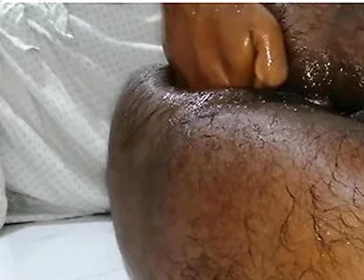 තම පකට තම අතමය පටටම ෆසටන එකක කර වදනව Extreme Self Fisting Best One Ever Huge Cum Load