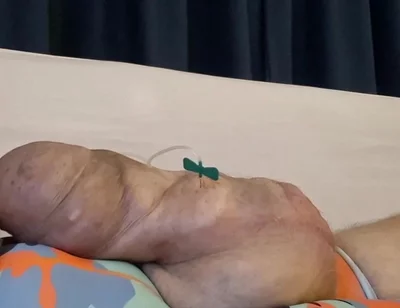 What a Big Obscene Package of Silicone Meat