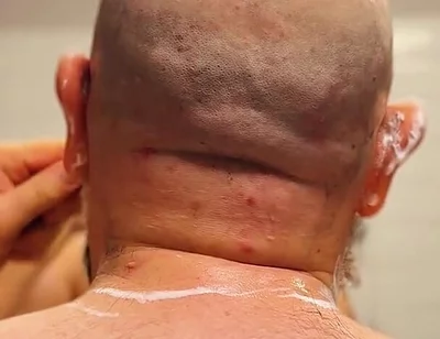 Shave Bald Head and Worship