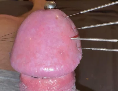 Needles Through the Thick, Hard Glans, Mega Orgasm