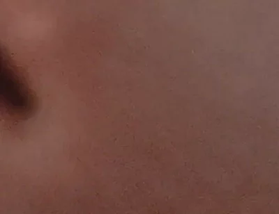 Amazing Closeup of the Widened Hole!!