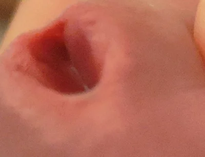 Amazing Closeup of the Widened Hole!!