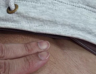 The Hair on My Penis - Led Hair Removal