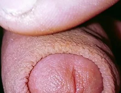 Caress and Suck a Small