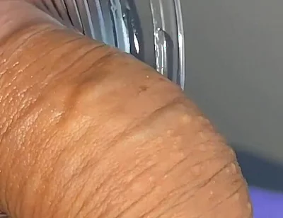 Mysterious Solution Inserted Into the Wrinkled Cock.
