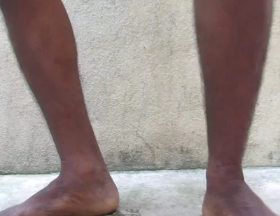 Mature Hairy Indian Cock Hair Removel After Oil Masturbation to Release Cum