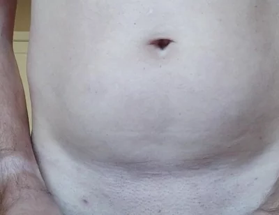 Dilatator