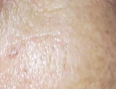 Milk Bath