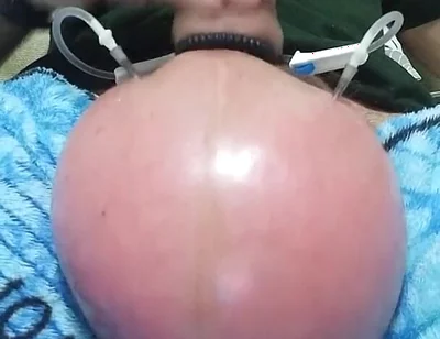 Saline - 2.5 Liters