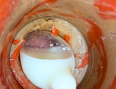 The Camera 4K Inside the Deep Pussy Records a Huge Ejaculation with a Stuck Condom