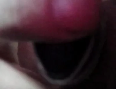Fisting