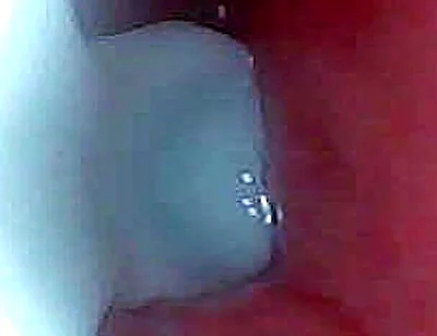 I Couldn’t Believe What Happens Inside the Penis as Sperm Passes Through (endoscopic Footage)