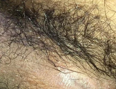 I Need You to Put Your Penis in I Can't Stand This Fever Anymore