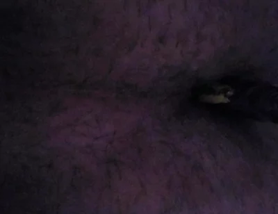 I'm Sticking a Razor Blade up My Ass.