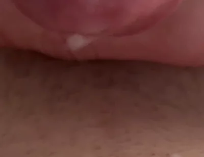 Sperm