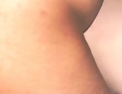 Smooth Skin