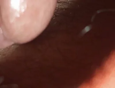 Super Anal