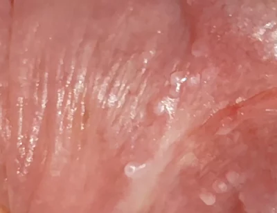 Wide Hole Filled with Pre Cum in Close up