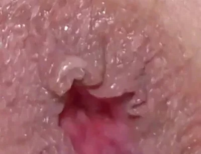 Extreme Closeup Dildo Anal Creampie