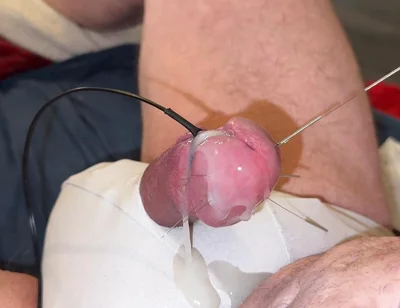 Acupuncture and Extremely Cumshot!