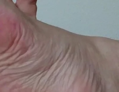 My Ugly Bare Feet in Bed