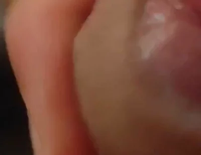 Great Phimosis Getting in the Way of the Boy's Orgasm