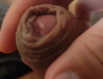Great Phimosis Getting in the Way of the Boy's Orgasm