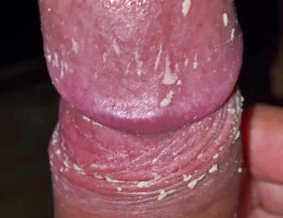 Checking My Dirty Dick