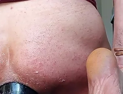 Fireworks of Sperm After a Major Dilation