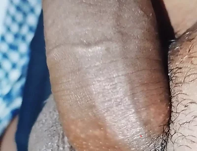 Penis