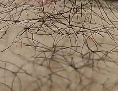I'm Hairy Boy This My Legs and Dick