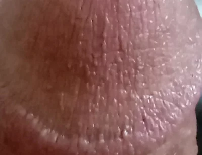 My Dick