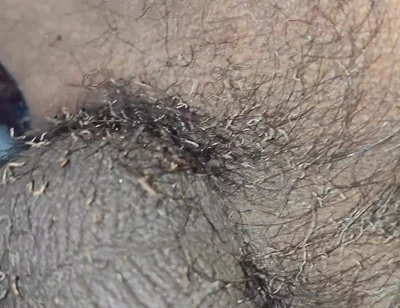 My Bushes Catch Fire Burning Penis Shaved Penis by Fire