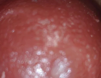 Deep Thrusts Trigger Feverish Cum Inside Without Sperm's Trace
