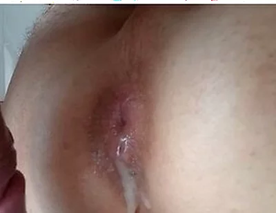 The Second Portion Of Cream Was Rubbed Into The Leaking Hole