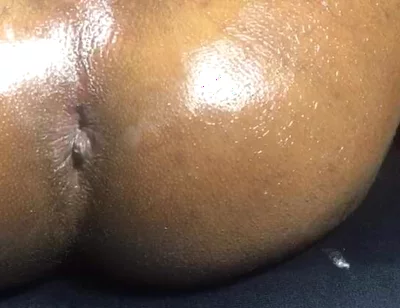Honey Ass