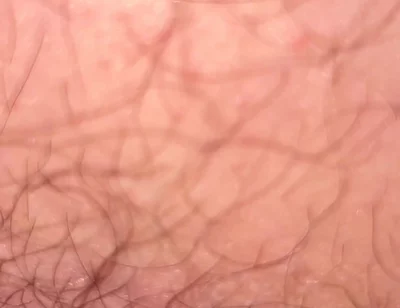 Close up Hairy Hole