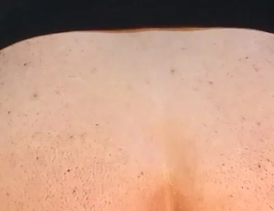 He Enjoys Sucking on His Anal Prolapse