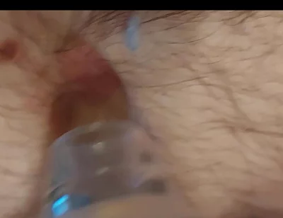 A Close-up Shot of My Belly Button as I Play with It