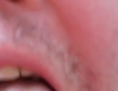 Camera Blunder in the Attempt at Facial Insemination