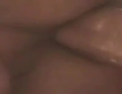 Gaping Anal Prolapse Overflow - Rosebud Pulsing Wide Open