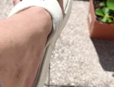 Summer Heels
