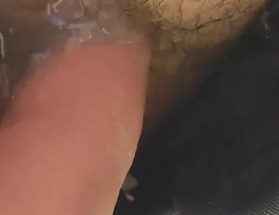 Uncircumcised Phimosis Has the First Ejaculation.