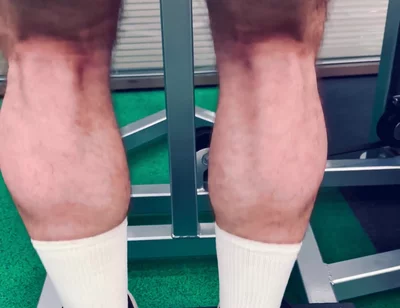 My Legs